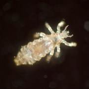 Head Lice related image